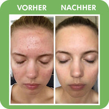 Lade das Bild in den Galerie-Viewer, SKINCARY™ - Poren Tiefenreinigungsmaske